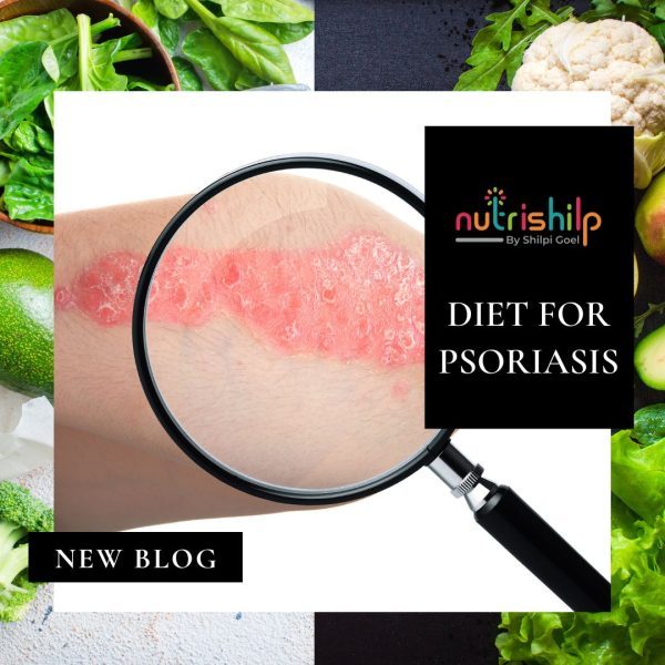 Diet in Psoriasis: Explore dietary strategies and foods that may help manage psoriasis symptoms and promote skin health.